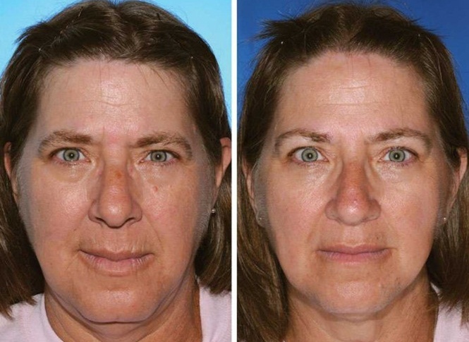 7 Gêmeos idênticos mostram os efeitos de fumar na aparência