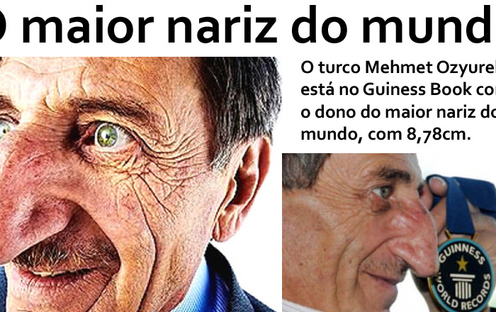 Conheça o homem que tem o maior nariz do mundo