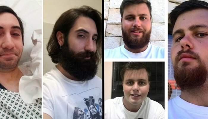 18 imagens mostram como a barba muda o visual