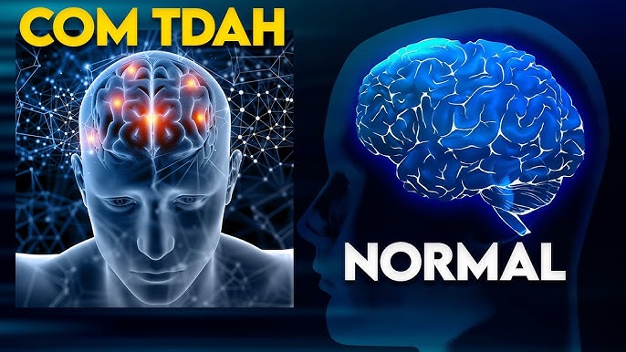 TDAH e Dopamina: Neurotransmissor Influencia o Transtorno